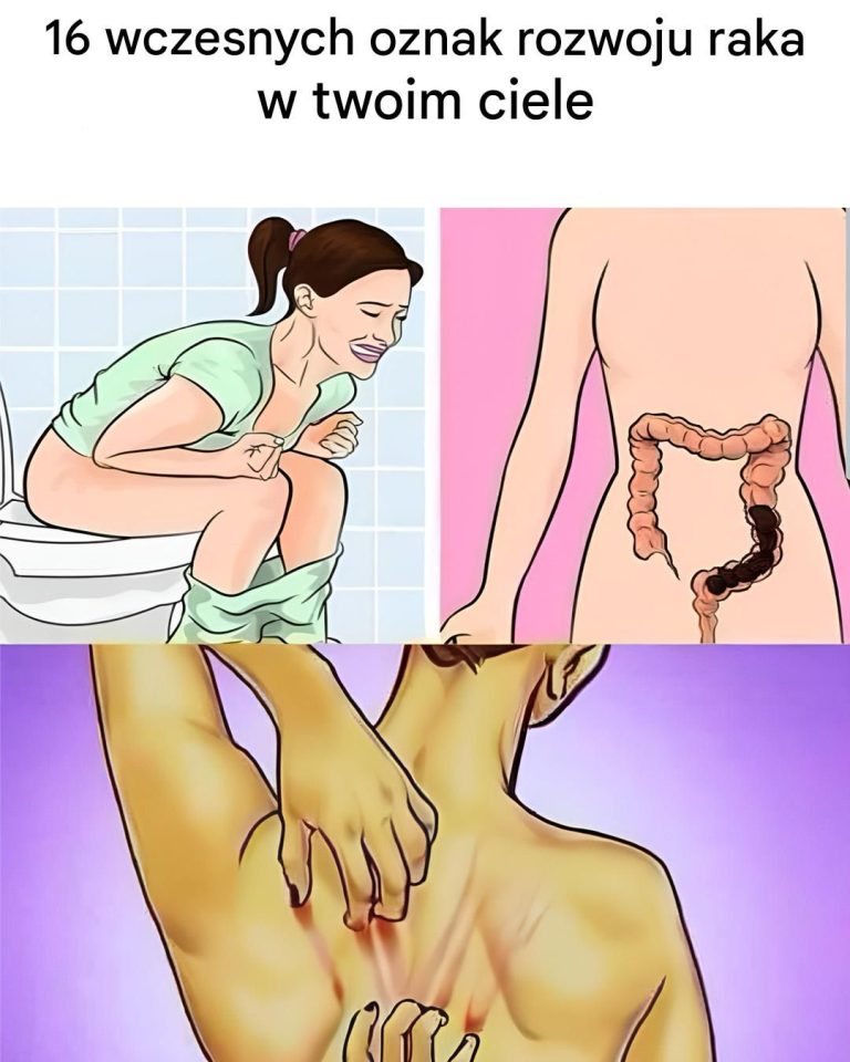 16 ostrzegawczych objawów raka