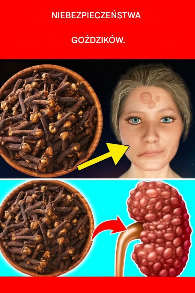 Unikaj goździków, jeśli masz następujące problemy zdrowotne…