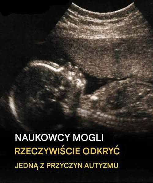 Badanie wykazało możliwy związek z rozwojem autyzmu. Zobacz więcej
